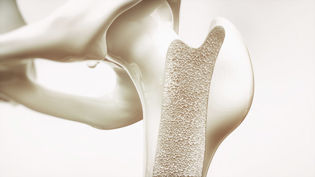 osteoporosis and marine collagen